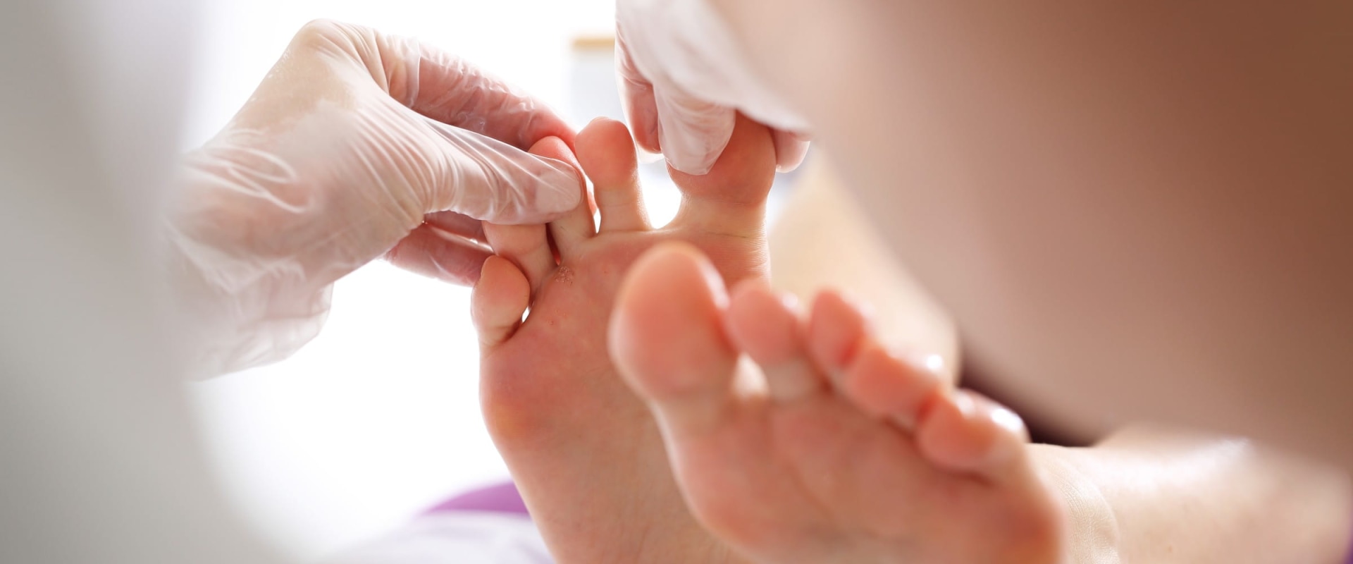 Recognizing the Early Signs of Pre-Diabetes: Understanding Symptoms and Effective Treatment Options for Prevention